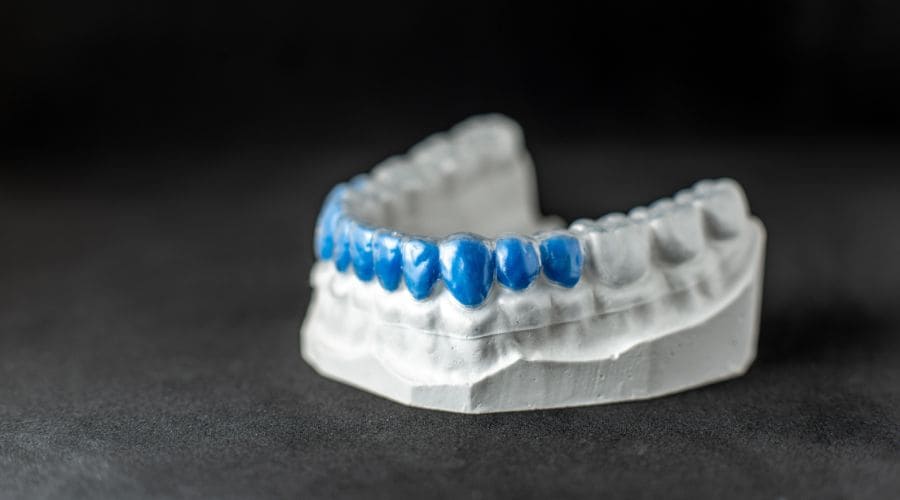 Laboratorio ferulas ortodoncia en Málaga