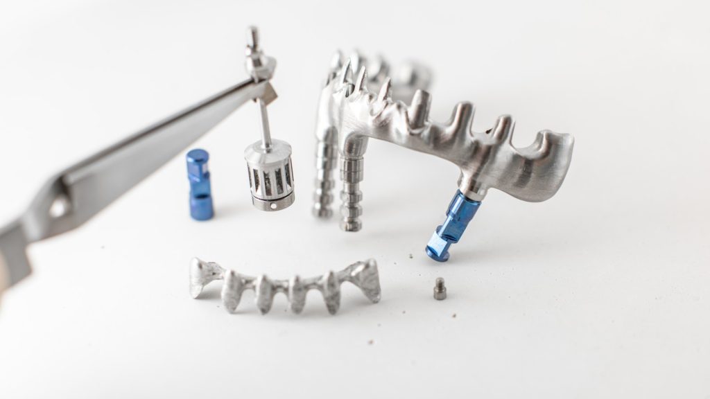 Dentadura postiza fija: tipos, materiales y cuidados