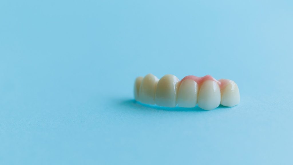 Puente y corona de zirconio: monolítico o estratificado, número de piezas y tallado